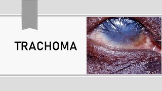 Trachoma Lecture [upl. by Ambrosia]