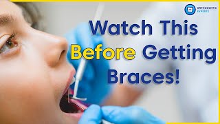 What To Know Before Getting Braces  8 Tips To Prepare You For Braces [upl. by Tice]