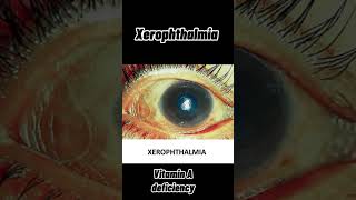 Xerophthalmia nightblindness xeropthalmia in animals animals veterinary vitamin A deficiency [upl. by Aivon]