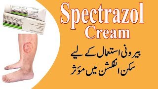 Spectazole cream uses in urdu  Clotrimazole and betamethasone dipropionate cream [upl. by Adey]