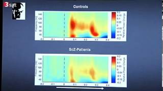 Schizophrenie  Was passiert im Kopf [upl. by Neroc762]