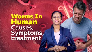 Worms In Human  Causes Symptoms treatment  Healthy Life Style  Worm Diseases [upl. by Essa754]