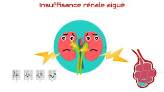 Insuffisance rénale aiguëdéfinition et classification [upl. by Renie]