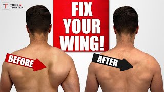 FIX Scapular Winging with Shoulder Blade Exercises [upl. by Alenson]