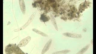 Protozoans and rotifers [upl. by Keener475]