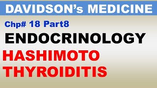 Davidsons Medicine Chp18 Part8  HASHIMOTO Thyroidits  Endocrinology  Dr Asif Lectures [upl. by Namso649]