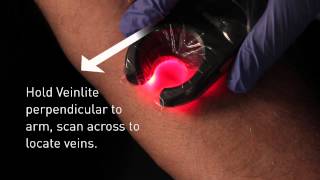 Veinlite LED Vein Finder Demo [upl. by Trawets581]