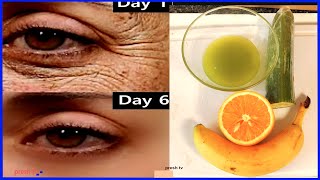 80 year old remove wrinkles under eyes using Cucumber remedy for 3 days  eye wrinkles home remedy [upl. by Erialcyram]