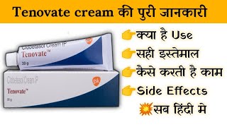 tenovate cream uses  price  composition  dose  side effects  review  in hindi [upl. by Assira412]