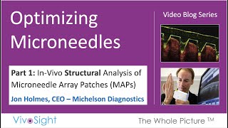 Optimization of Microneedle Array Patches MAPs Part 1 InVivo Structural Analysis [upl. by Hanima]