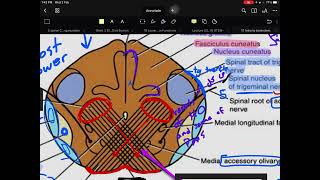 1 internal medulla oblongata pyramidal decussation level [upl. by Ahseenal]