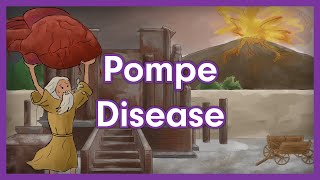 Pompe Disease  Glycogen Storage Disease Mnemonic for USMLE [upl. by Evetta]