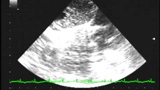 Heartworm disease echocardiography [upl. by Shishko585]