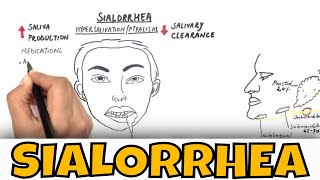 Sialorrhea  Drooling  Causes Clinical features and Treatment [upl. by Kei]