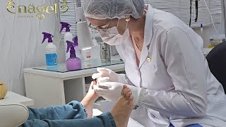 😍 UM PROCEDIMENTO MUITO ESPECIAL  Paciente de 4 anos satisfying viral [upl. by Ahsiekar]