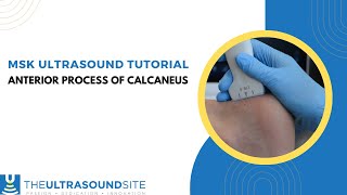 MSK ultrasound evaluation on how to find the anterior process of the calcaneus [upl. by Odlonyer637]