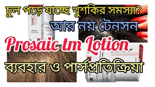 খুশকি ও চুলপড়ার অন্যতম ঔষধprosalic lotion usesprosalic lotion bangla reviewmedicine knowledge bd [upl. by Retxed]