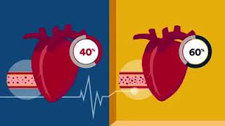 Ejection Fraction  Heart Health  Rose Heart amp Vascular Center [upl. by Miahc]