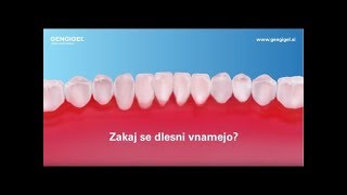 Zakaj se dlesni vnamejo [upl. by Engen]