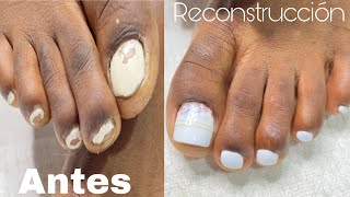 Reconstruccion de uñas de pies con polygel acripie desde el principio [upl. by Dorsey]