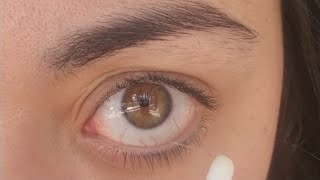 Compilation of eye junk removal Eye fishing syndrome 🎣🎣 [upl. by Scherman]