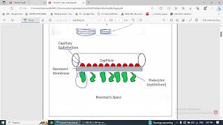 Nephritic Syndrome [upl. by Roye]