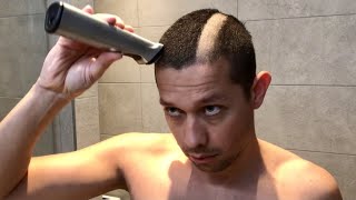 Back to Bald 🪒 Getting Rid of 3 Week Fuzz  Full Headshave [upl. by Moon]