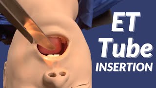 How to Insert an Endotracheal Tube ET Tube [upl. by Ecirtael]