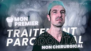 Mon Premier Traitement Parodontal NON CHIRURGICAL [upl. by Lraed765]