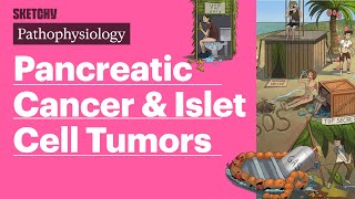 Pancreatic Cancer amp Islet Cell Tumors Pathophysiology  Sketchy Medical [upl. by Merwin523]