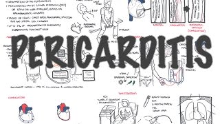 Pericarditis  Overview signs and symptoms pathophysiology diagnosis treatment [upl. by Ikoek450]