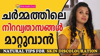 Skin Discoloration Treatment Home Remedies  Skin Pigmentation Home Remedies In MalayalamSkin Care [upl. by Aniretac676]