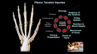 Flexor Tendon Injuries  Everything You Need To Know  Dr Nabil Ebraheim [upl. by Worden219]