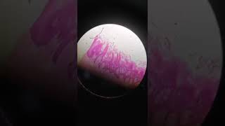 Histological slide of tongue showing filiform and fungiform papillae [upl. by Auria]