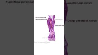 Common peroneal nerve lesion  features [upl. by Notseh869]