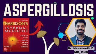 ASPERGILLOSIS  Pathogenesis  Clinical Features  Diagnosis  Treatment  Harrison [upl. by Benito]