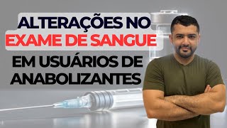 Exame de sangue e anabolizante é isso que pode acontecer [upl. by Titania854]