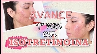 DIARIO DE MI ACNE  PRIMER MES CON ISOTRETINOINA  LizQuintana [upl. by Starr]