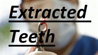 What Can Be Done If Teeth Are Already Extracted by Prof John Mew [upl. by Atteuqal]