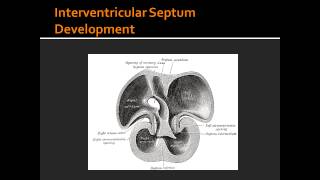 Interventricular Septum Development [upl. by Asreht267]