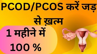 PCODPCOS Thik karne ke gharelu Upaay  how to cure pcos and get pregnant  pcos thik kaise kare [upl. by Royd179]