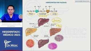 Gastroenterología  13 Hepatopatias por Alcohol [upl. by Hayes696]