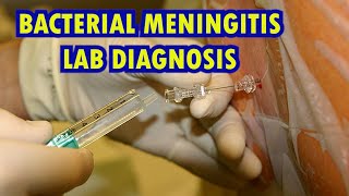 BACTERIAL MENINGITIS LAB DIAGNOSIS [upl. by Cristionna711]