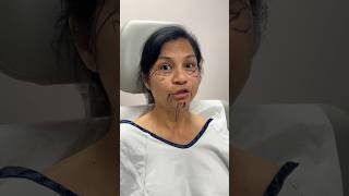 How Old is She 😳 Plastic Surgery Transformation facelift [upl. by Anihsat]