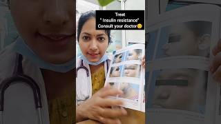 Read the description drdivya doctor drdivyat acanthosisnigricans darkneck healthtipinkannada [upl. by Blinni]