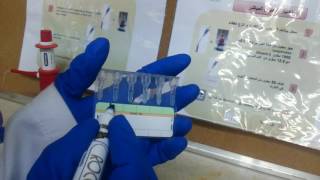 اختبار كومبس المباشر طريقة الجل Direct coombs test gel method [upl. by Halak]