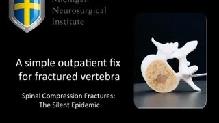 A simple outpatient fix for fractured vertebra [upl. by Alithea]