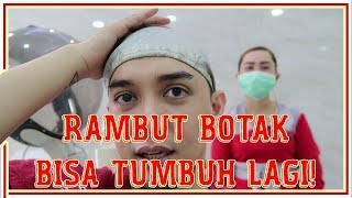 INI LOH TERNYATA PENYEBAB RAMBUT BOTAK  Part 1  Ichsan Akbar [upl. by Sami]