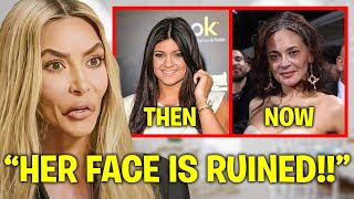 Kim Kardashian EXPOSES Kylie Jenner’s BOTCHED Plastic Surgery [upl. by Gordon699]