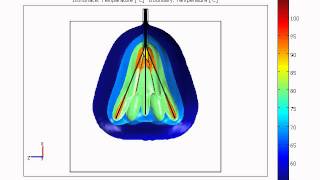 RF Volumetric Thermal Ablation [upl. by Thibaud255]